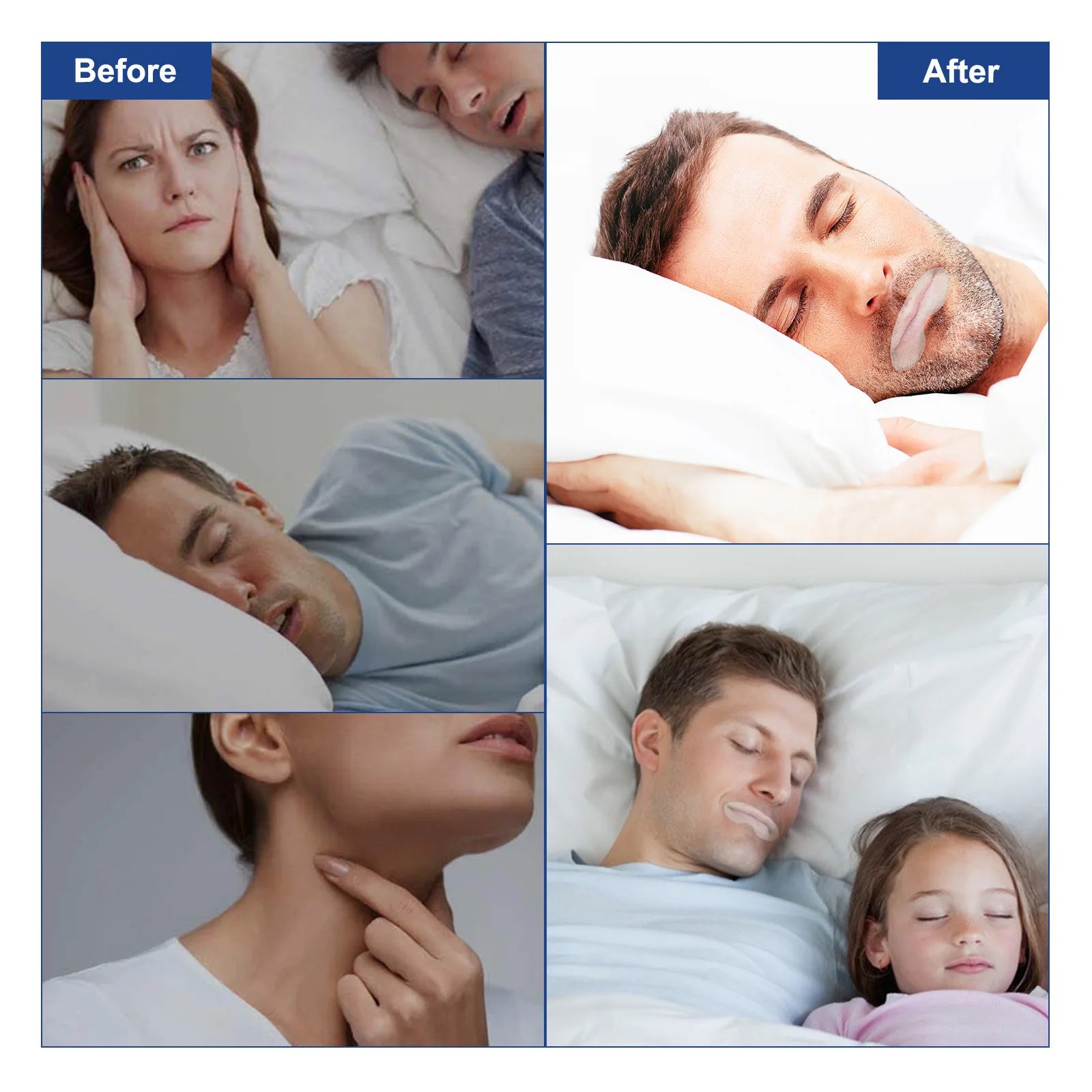 Anti-Snoring Sleep Strips – Disposable Mouth Tape for Better Nose Breathing