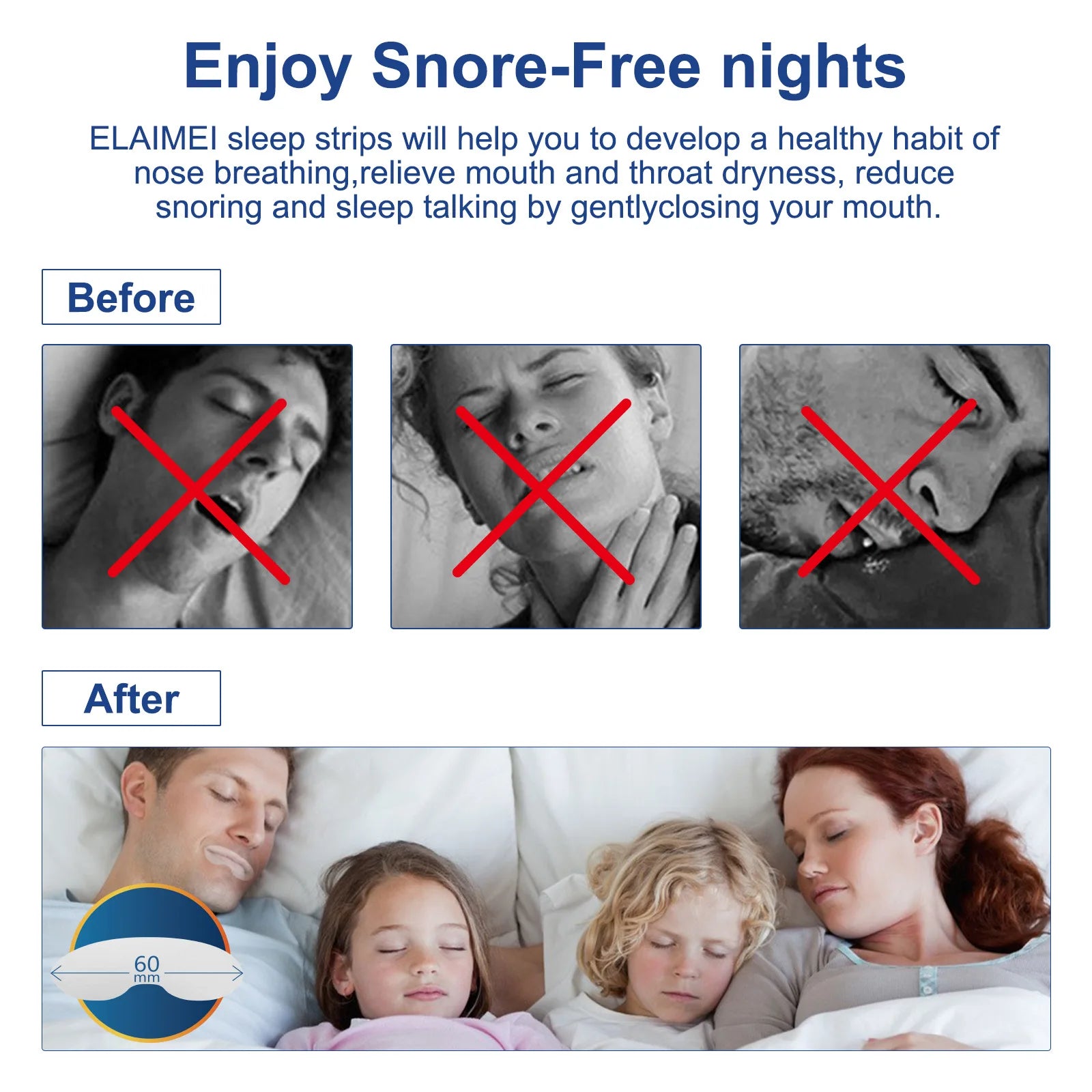 Anti-Snoring 